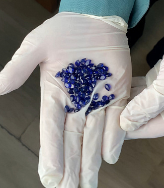 Дело собирания контрабадных драгоценных камней прервалось заведением уголовного дела