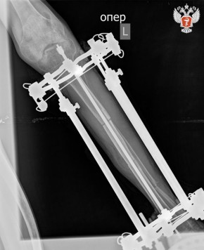 ����� ���� ������������� � ��������� ��. ��. �. �. ��������� ��������� ������ ������ �� ���� ��������� � ������������ ���������